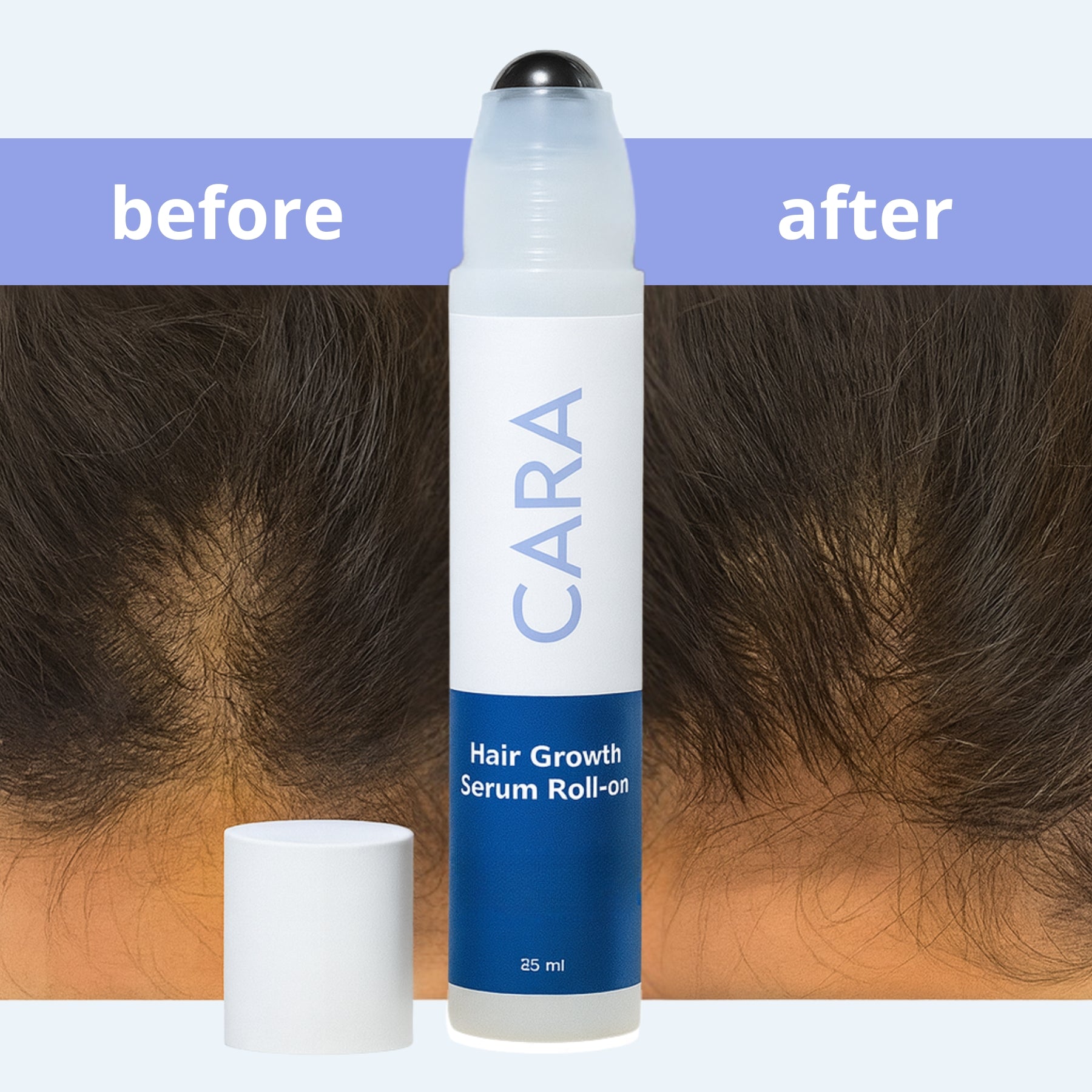 CARA™ - RootGlow